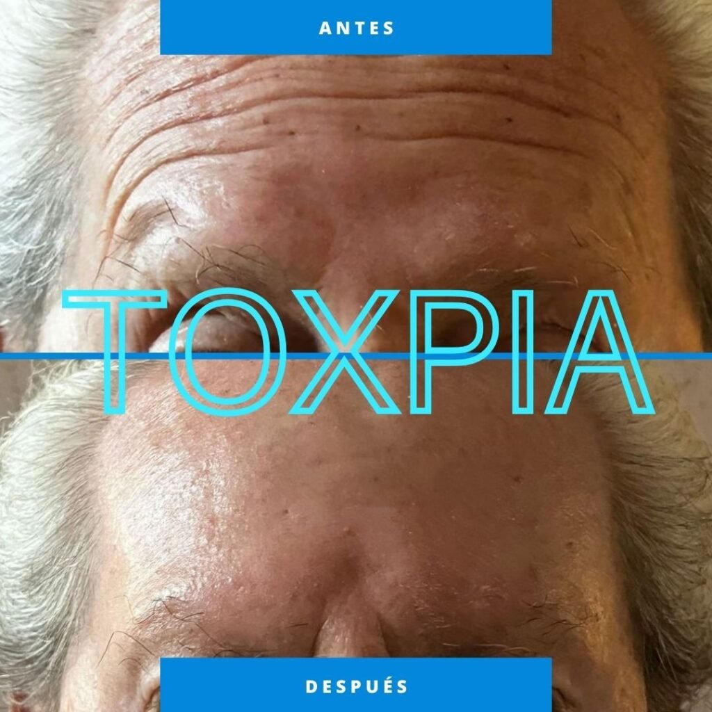 Resultados 3 toxpia